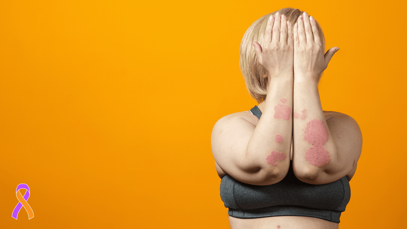 Your Skin’s Worst Nightmare? Avoid These 7 Eczema Triggers